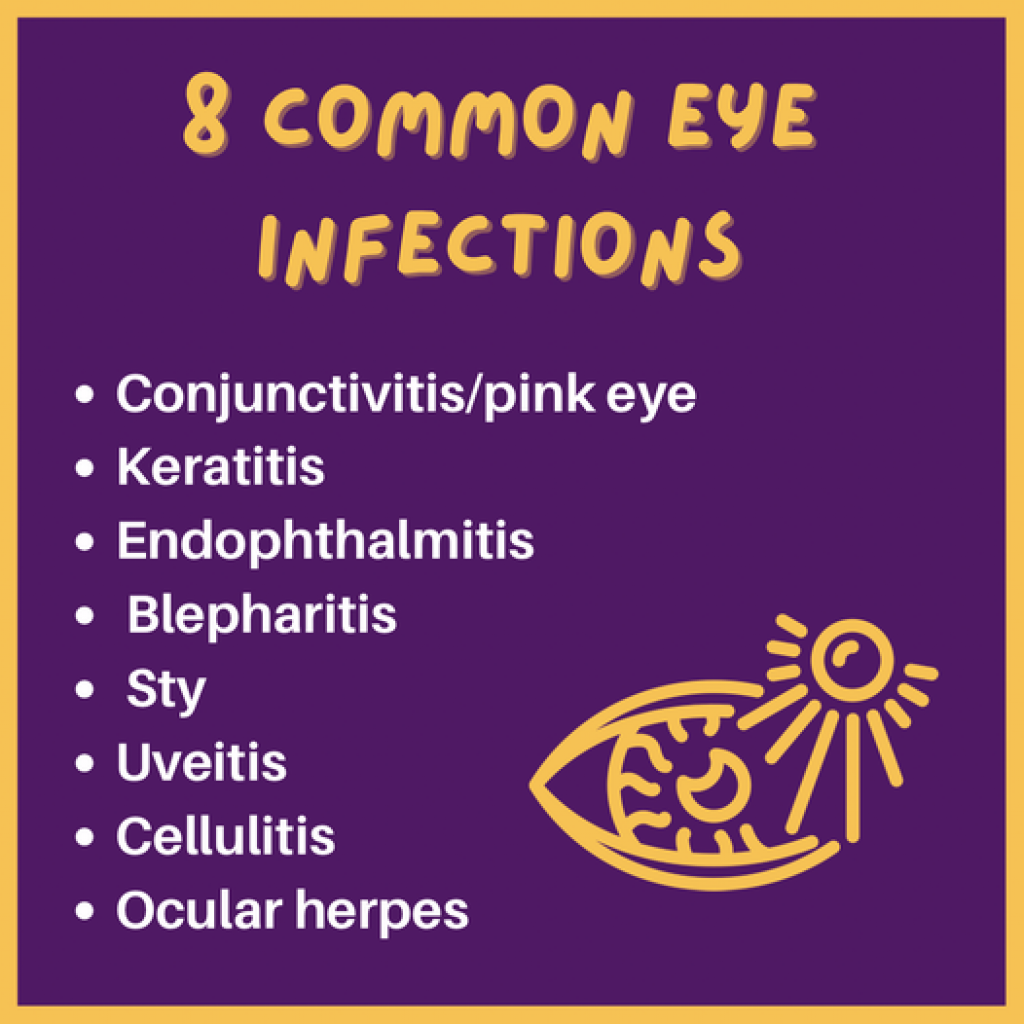 Unique Tips About How To Avoid Eye Infections